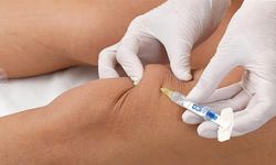 Kireçlenmenin kısa sürede tedavisi mümkün