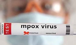 Pakistan'da maymun çiçeği vakalarında artış