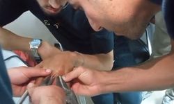 Parmağına sıkışan yüzük itfaiye ekiplerince çıkarıldı