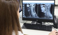 Uzmanından uyarı: Multiple Skleroz her hastada farklı seyrediyor