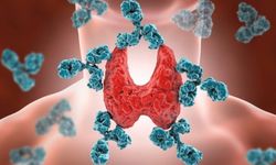 Haşimato belirtileri ve hakkında uzmanından uyarılar