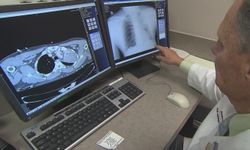 ABD'de akciğer vebası nedeniyle ölüm