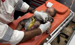 BM Raportörü Albanese: israil çocukları kasten öldürüyor