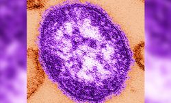 İngiltere'de kızamık salgını can aldı