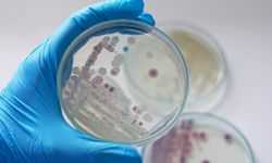 ABD'de et yiyen bakteri alarmı 