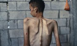 Gazze'de açlık felaketi: 106'sı çocuk 235 şehit