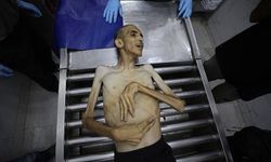 Gazze’de açlıktan ölümler yürek burkuyor