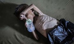 Gazze'de Guillain-Barré salgını ve kitlesel ölüm riski