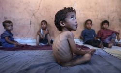Gazze açlıktan ölüyor dünya izliyor