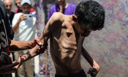 Gazze’de son 24 saatte açlıktan 2 kişi daha şehit oldu