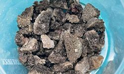 Malatya'da bir hasta, "Geyik boynuzu böbrek taşı"ndan ameliyatla kurtuldu