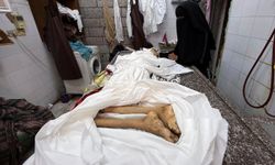 MSF: BM'nin Gazze'deki açlık ilanı sonrası durum değişmedi