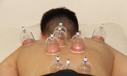 Şifa geleneğinde özel tarih: 9 Eylül Altın Hacamat Günü