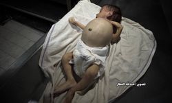 Son 24 saatte Gazze’de açlıktan 4 kişi şehit oldu