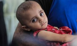 UNICEF uyardı: Gazze'de çocuklar arasında kötü beslenme oranı alarm verici seviyeye ulaştı
