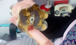 Batman’da parmağı blendere sıkışan vatandaşa acil müdahale