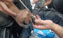 Batman'da parmakta sıkışan yüzük operasyonla çıkarıldı