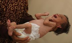 İki çocuk daha Gazze'de açlıktan şehit oldu