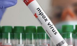 Namibya'da ilk M Çiçeği vakası tespit edildi