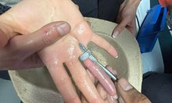 Parmağına sıkışan yüzük ifaiye ve doktorların müdahalesiyle çıkarıldı