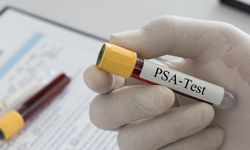 Üroloji Uzmanı Ataman:  Prostat kanseri çoğu zaman belirti vermeden ilerler