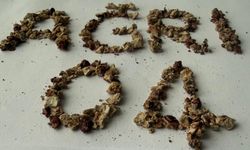 Ağrı'da gerçekleştirilen ameliyatta 295 taş başarıyla çıkarıldı