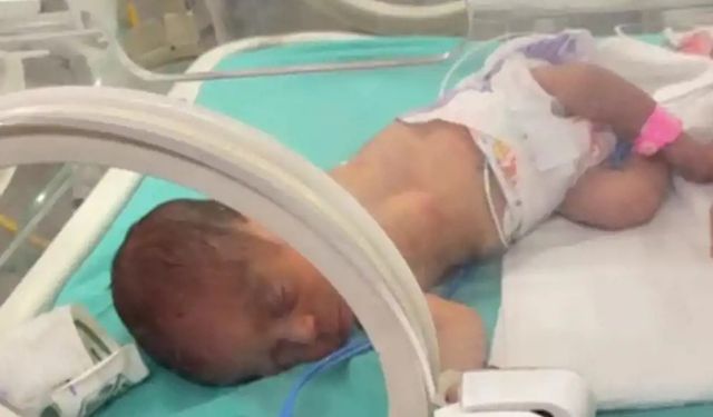 Gazze'de doktorlar, şehit olan hamile kadının bebeğini kurtardı