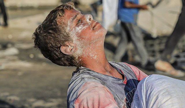 Gazze'de açlık derinleşiyor: ABD yanıltıcı açıklamalarla gerçek durumu gizliyor