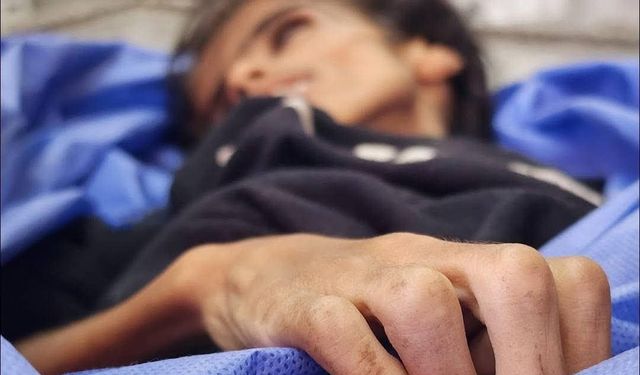 Gazze'de ikisi çocuk 14 kişi daha açlıktan öldü