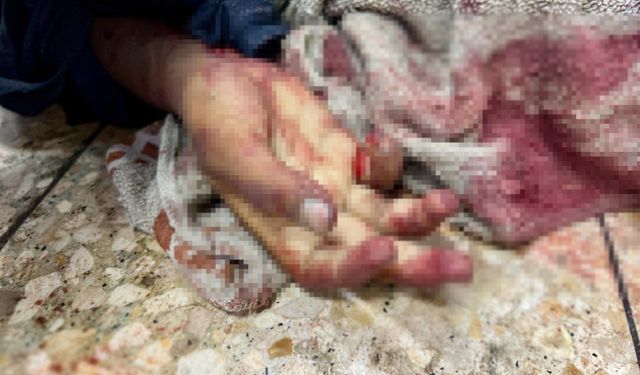 Gazze'de kanlı sabah: Açlık ve saldırılar 47 can aldı