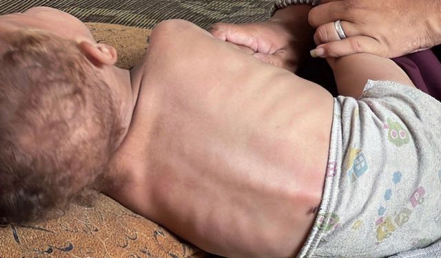 Son 24 saatte Gazze’de açlıktan 11 kişi daha şehid oldu