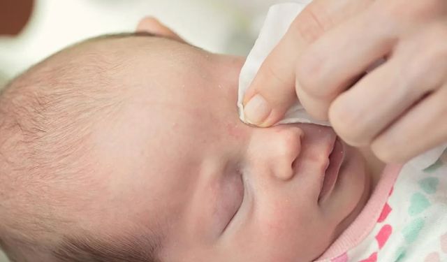 Bebek ve çocuklarda göz sulanması tedavisi