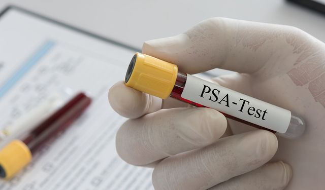 Üroloji Uzmanı Ataman:  Prostat kanseri çoğu zaman belirti vermeden ilerler