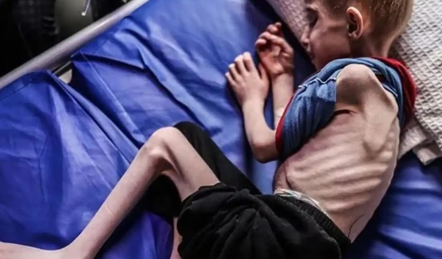Gazze’de açlıktan dolayı şehit olanların sayısı 263’e yükseldi